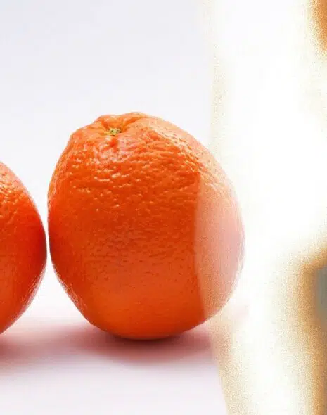 cremas anticelulíticas