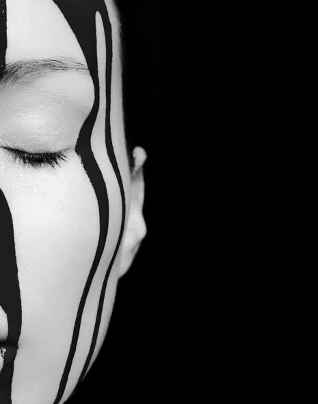 dermatitis seborréica