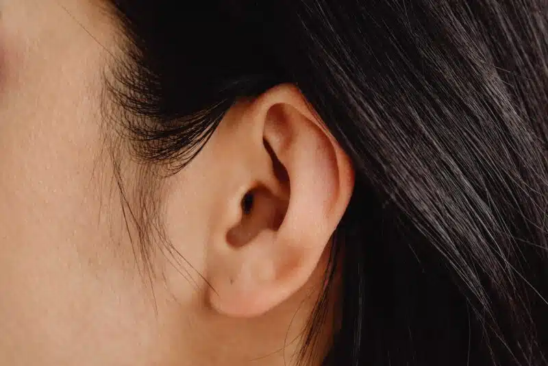operación de las orejas