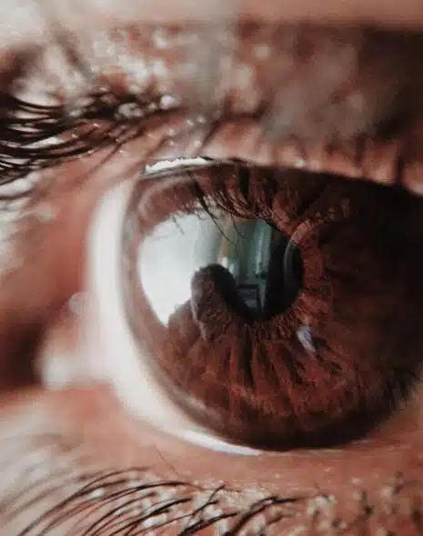 ¿Cómo prevenir las cataratas?